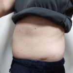 Vアップシェイパー体験 横 2-9