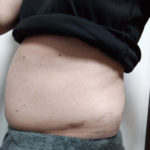 Vアップシェイパー体験 横 2-10