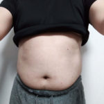 Vアップシェイパー体験 前 2-12