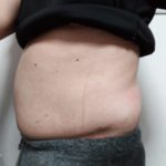 Vアップシェイパー体験 横 2-12