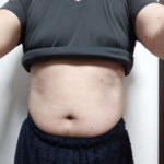 Vアップシェイパー体験 前 2-13