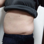 Vアップシェイパー体験 横 2-13