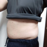 Vアップシェイパー体験 横 2-14