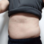 Vアップシェイパー体験 0217