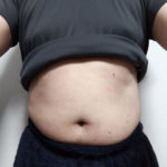 Vアップシェイパー体験 0219