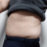 Vアップシェイパー体験 0219