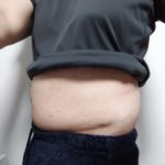 Vアップシェイパー体験 0221