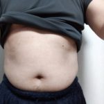 VアップシェイパーEMS 前 1/30