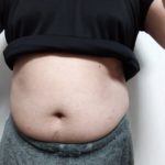 VアップシェイパーEMS 前 2/1