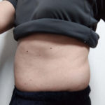 ＶアップシェイパーEMS体験 2.25