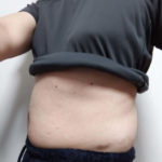 vアップシェイパーemsレビュー