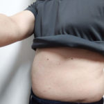 vアップシェイパーemsレビュー