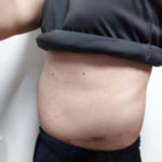 vアップシェイパーems体験