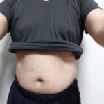 Vアップシェイパー体験
