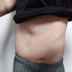 ＶアップシェイパーEMS体験