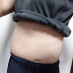 Ｖアップシェイパー体験ブログ