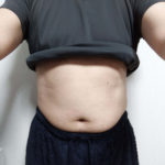 Ｖアップシェイパー体験