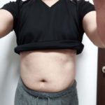 VアップシェイパーEMS