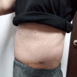 VアップシェイパーEMS