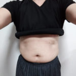 VアップシェイパーEMS