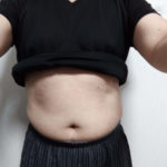 vアップシェイパーems