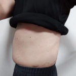 VアップシェイパーEMS