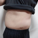 VアップシェイパーEMSレビュー