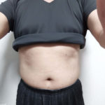 VアップシェイパーEMS体験