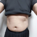 ＶアップシェイパーEMS