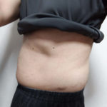 ＶアップシェイパーEMS