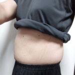 vアップシェイパーems