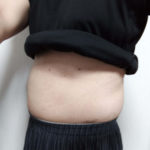 VアップシェイパーEMS