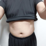 vアップシェイパーems