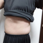 vアップシェイパーems