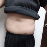 vアップシェイパーems