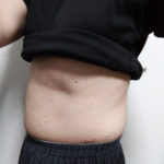 vアップシェイパー