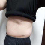 vアップシェイパーems体験