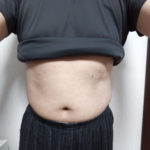 v upshaper emsダイエット結果