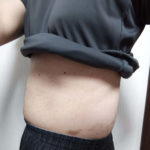 vアップシェイパーｅｍｓ