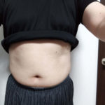 VアップシェイパーEMS