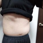 VアップシェイパーEMS