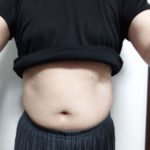 VアップシェイパーEMS効果