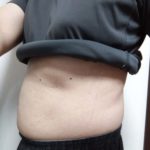 vアップシェイパーems使用結果