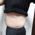 vアップシェイパーems効果