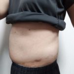 Vアップシェイパー