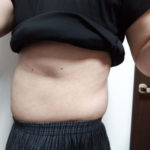 Vアップシェイパー効果