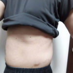 vアップシェイパーems体験